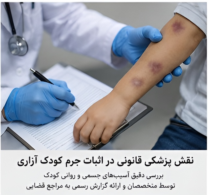 نقش پزشک قانونی در پرونده کودک ازاری