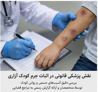 نقش پزشک قانونی در پرونده کودک ازاری